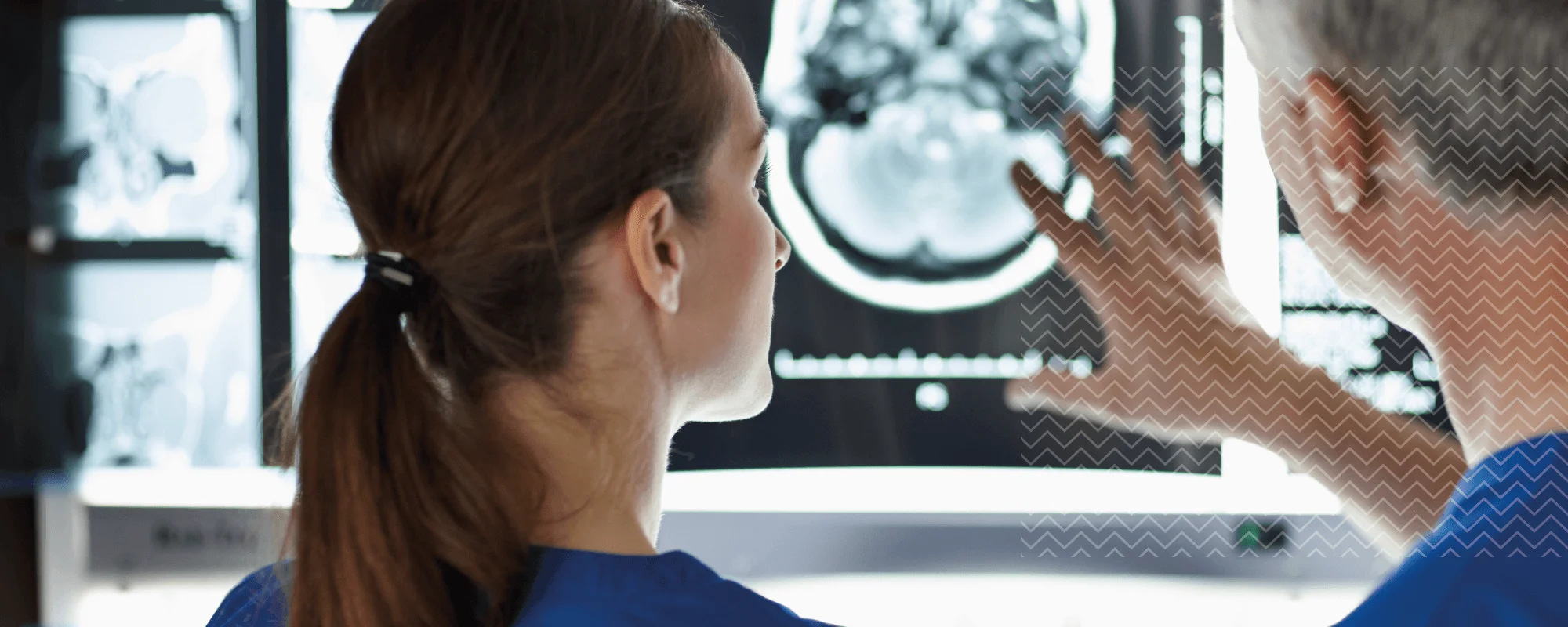 Profesionales de la salud observando una imagen cerebral, representando el estudio introductorio en neuropsicología