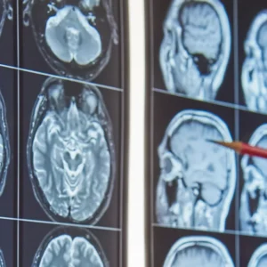 Imagen del producto del curso de rehabilitación neuropsicológica en DCA